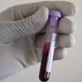 HIV/AIDS: A Growing Concern to Business